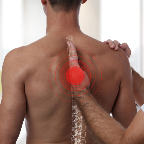 fisioterapia, RPG, postura e dor nas costas e lombar
